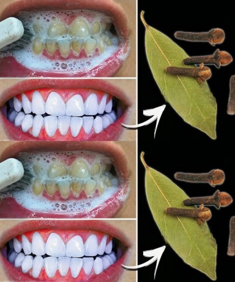 Rimuovi il tartaro e sbianca i denti in modo naturale