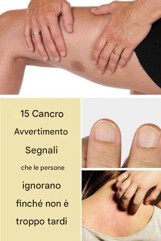 15 segnali di allarme del cancro che le persone ignorano finché non è troppo tardi